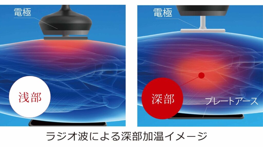 月間オススメメニュー じんわり温かく、体の内側から整う新感覚の温熱ケア。